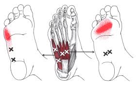 Referred Chart Foot