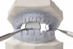 temporal mandibular joint dysfunction